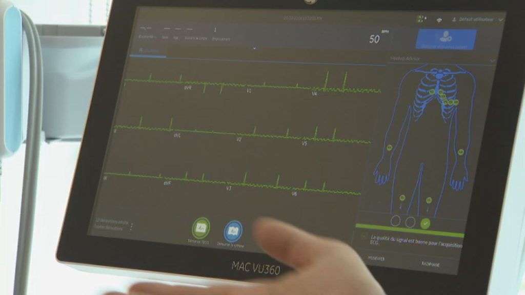 How Montreal cardiologists are turning to AI to predict heart problems